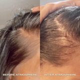 Aphrodite Hair Density Kit