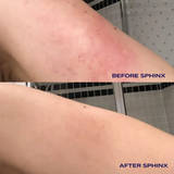 Sphinx Body Experience Oil | For Eczema and Roseacea Relief