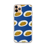 Noods iPhone Case
