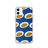 Noods iPhone Case